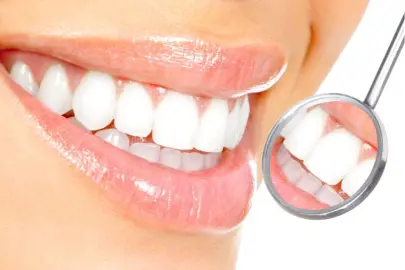 Diş beyazlatmada doğru bilinen yanlışlar!