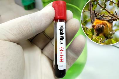 DSÖ: Nipah virüsü yüzde 75 ölüm oranına sahip ve bu oran Covid-19'un 5 katı