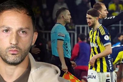Fenerbahçe'ye müjdeli haber! Zorlu maç öncesi Tedesco'nun umudu oldu