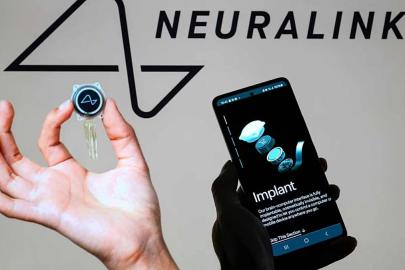 Otomatik ameliyatlar ve seri implant üretimi: Neuralink’ten yeni adım