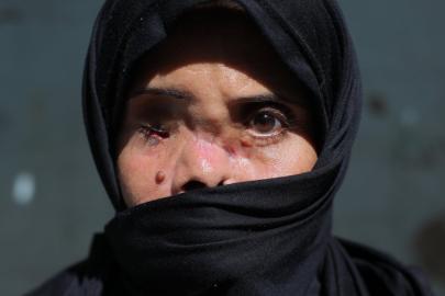 Gazze'de öldü sanılıp kefenlendikten sonra hayatta olduğu tespit edildi