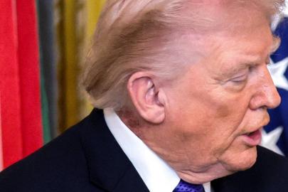 Trump'ın boynundaki leke gündem oldu: Beyaz Saray'dan açıklama geldi