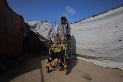 İsrail saldırısında yaralanan 4 yaşındaki Kamer, yeniden yürüyebilmenin hayalini kuruyor