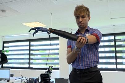 Meksika'da tek sensörle kontrol edilebilen biyonik kol geliştirildi