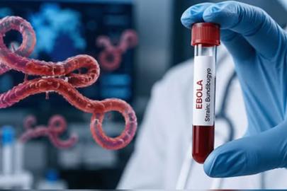 Ebola salgınına karşı acil önlem çağrısı: En ölümcül seviyeye ulaşmak üzere