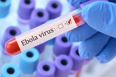 Fransa'da Ebola alarmı: Vakayla temas ettiği değerlendirilen 5 kişi karantinaya alındı