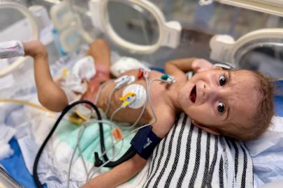 MSF: israilin kısıtlamaları nedeniyle Gazze'de hastaneler çalışamaz halde