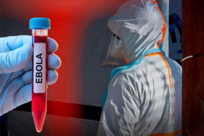 Nijerya'da ilk Ebola vakası doğrulandı