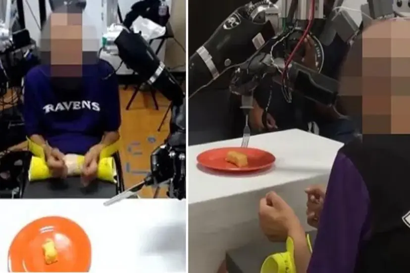 Dünya bu anları hayretle izledi! Felçli adamın beynine makine bağlandı, sonrasında olanlar doktorları bile şaşırttı