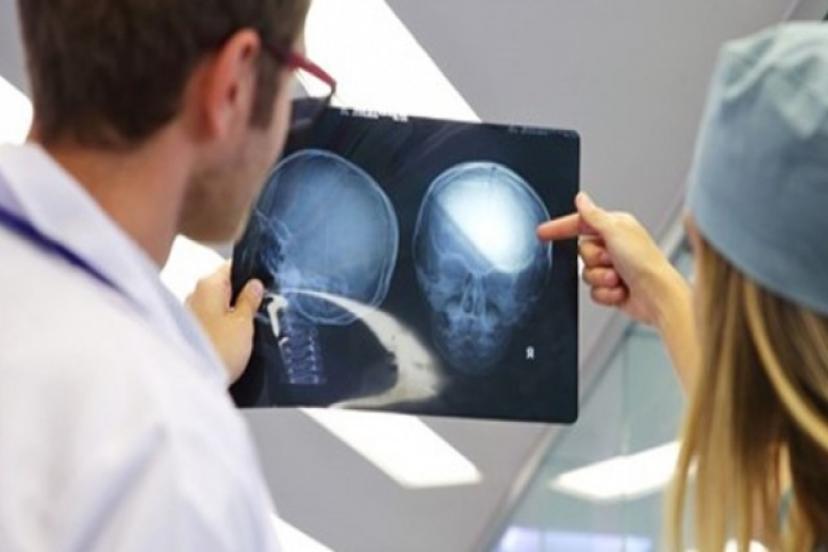 Dünyada İlk! Türk Bilim İnsanları Yaptı: Beyin Kanseri Tedavisinde Kullanılacak!