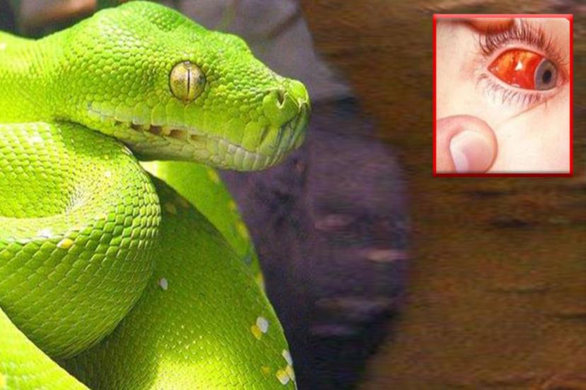 Dünyanın en zehirli yılanı! Soktuğu insanın her yerinden kan fışkırıyor