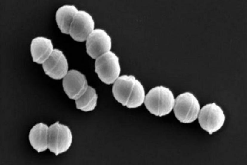 Dünyayı Korkutan Gelişme Et Yiyen Bakteri Hızla Yayılıyor