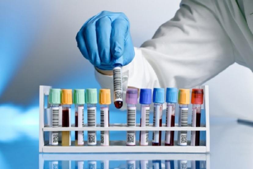 Erdoğan Duyurmuştu! Dışa Bağımlılığı Bitirecek İlacın Üretimi Resmen Başladı