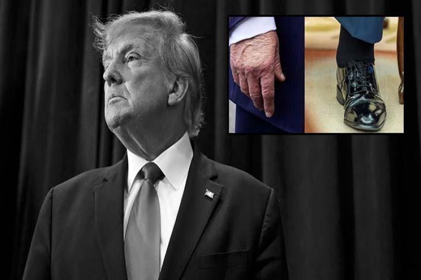 ABD Başkanı Trump'ın Gizemli Hastalığı Ortaya Çıktı!