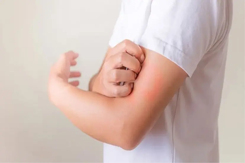 Hayalet hastalık "Lyme'a" dikkat! 300 hastalığı taklit ediyor