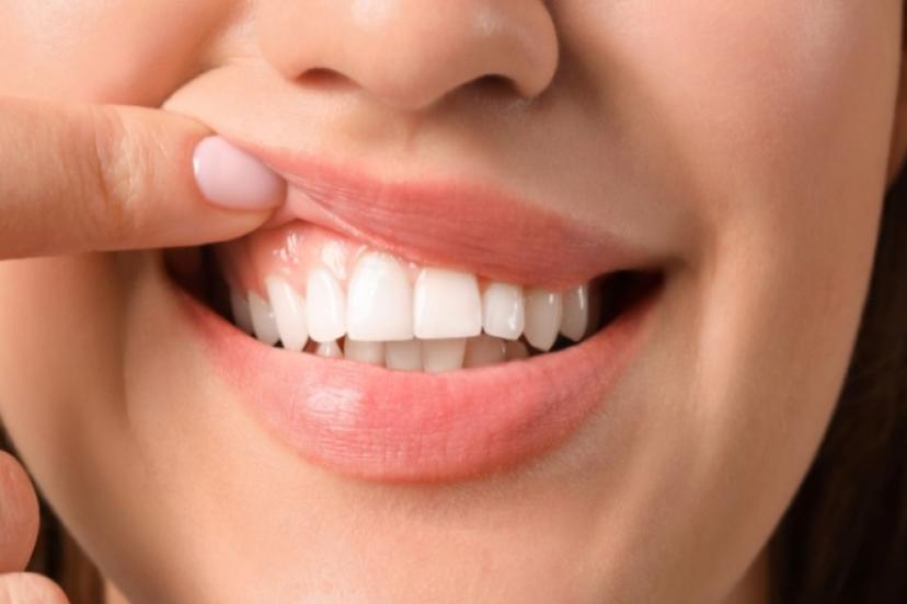 Japon bilim insanları dişlerin uzamasına ve yeniden çıkmasına yardımcı bir ilaç geliştirdi