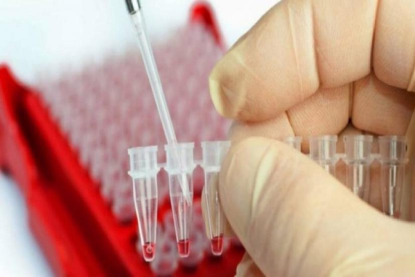 Sevindiren Gelişme: Kanser Hastalığını Önceden Tespit Eden Test Geliştirildi